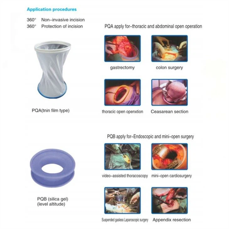 Wound Retractor
